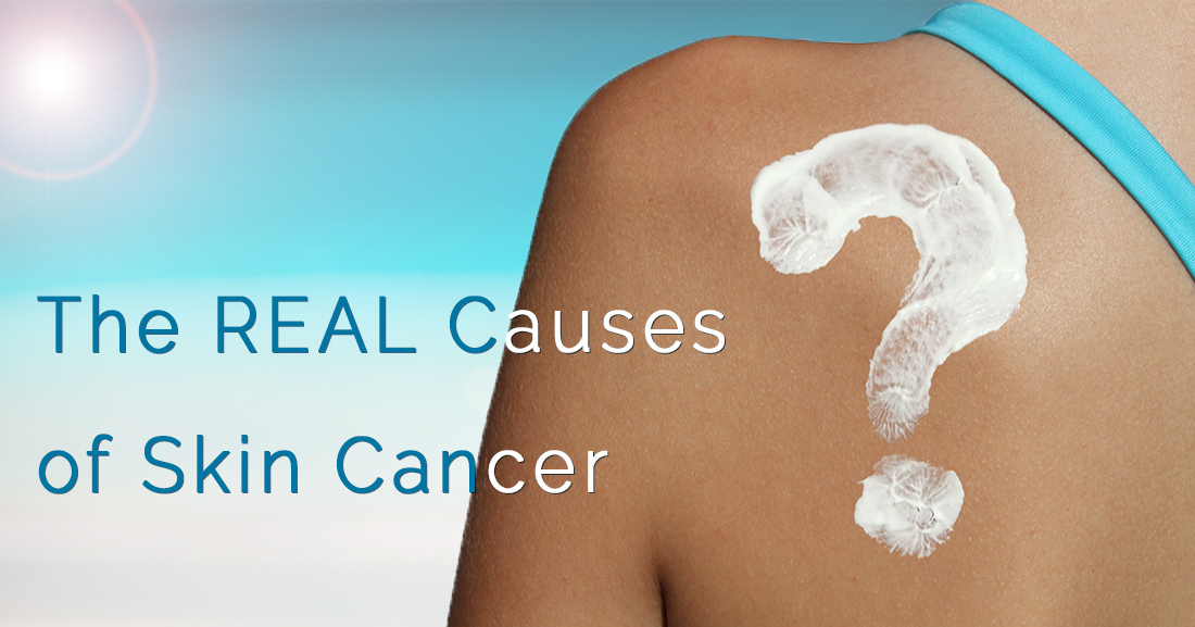 The REAL Causes of Skin Cancer